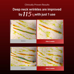 Meditherapy neck-mask-absorption-essence demonstrates deep hydration through generous serum