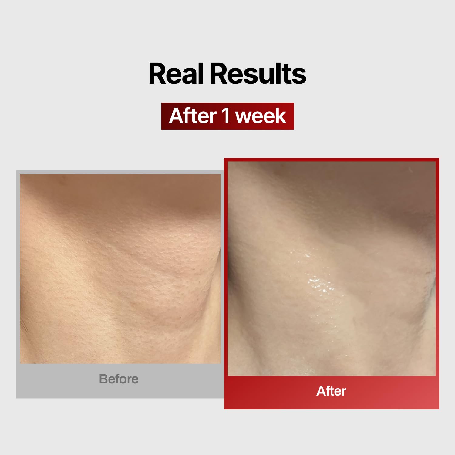 Meditherapy neck mask packaging shot emphasizes easy-at-home use and premium feel