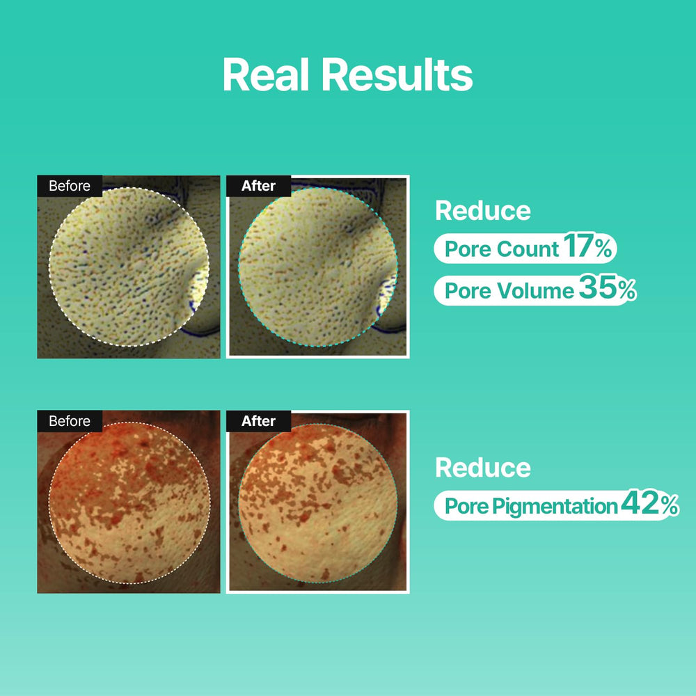 MEDITHERAPY Porethera lightweight texture applied for quick absorption and pore refinement