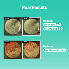 MEDITHERAPY Porethera lightweight texture applied for quick absorption and pore refinement