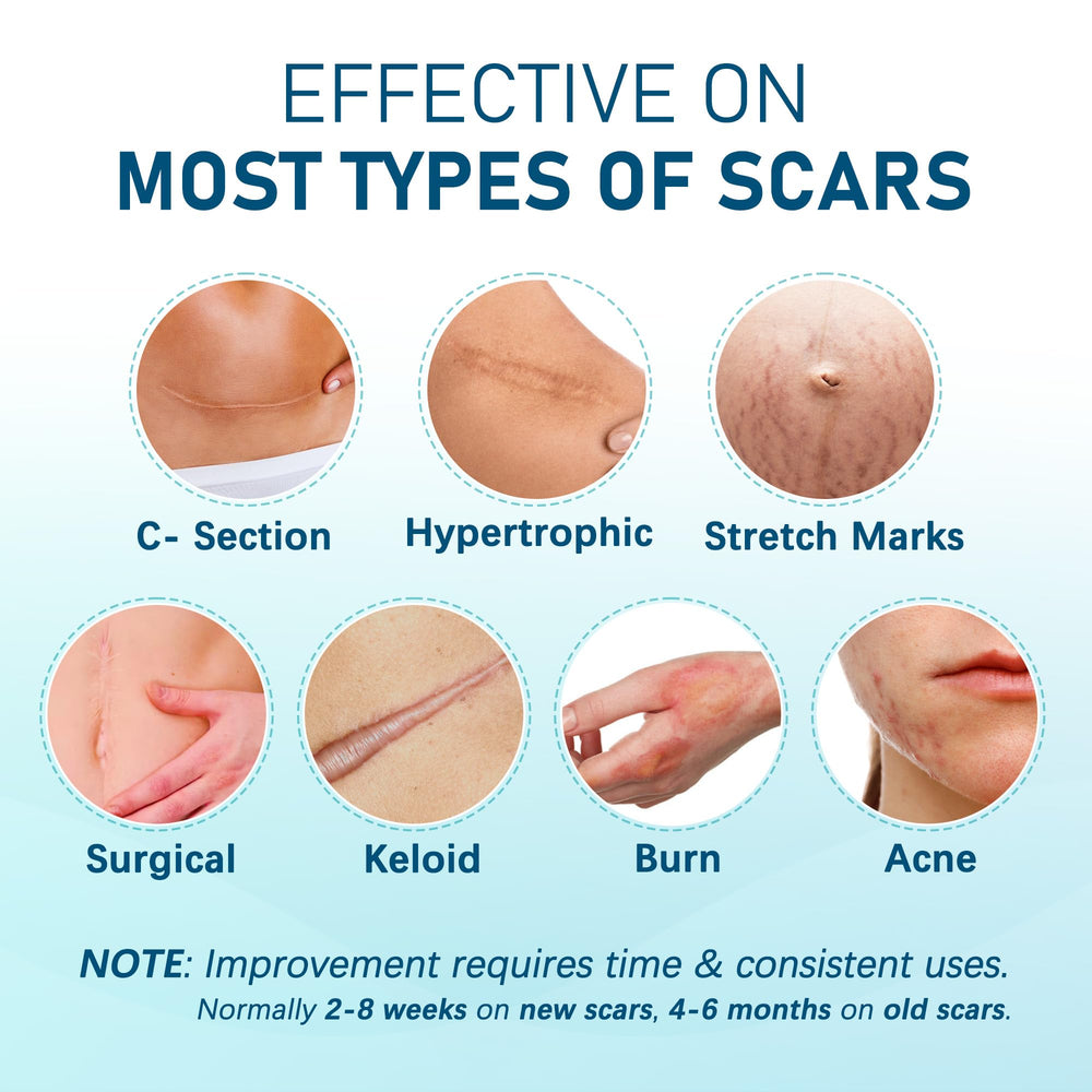 MEDLOT patch applied to healing C-section scar for comfortable coverage