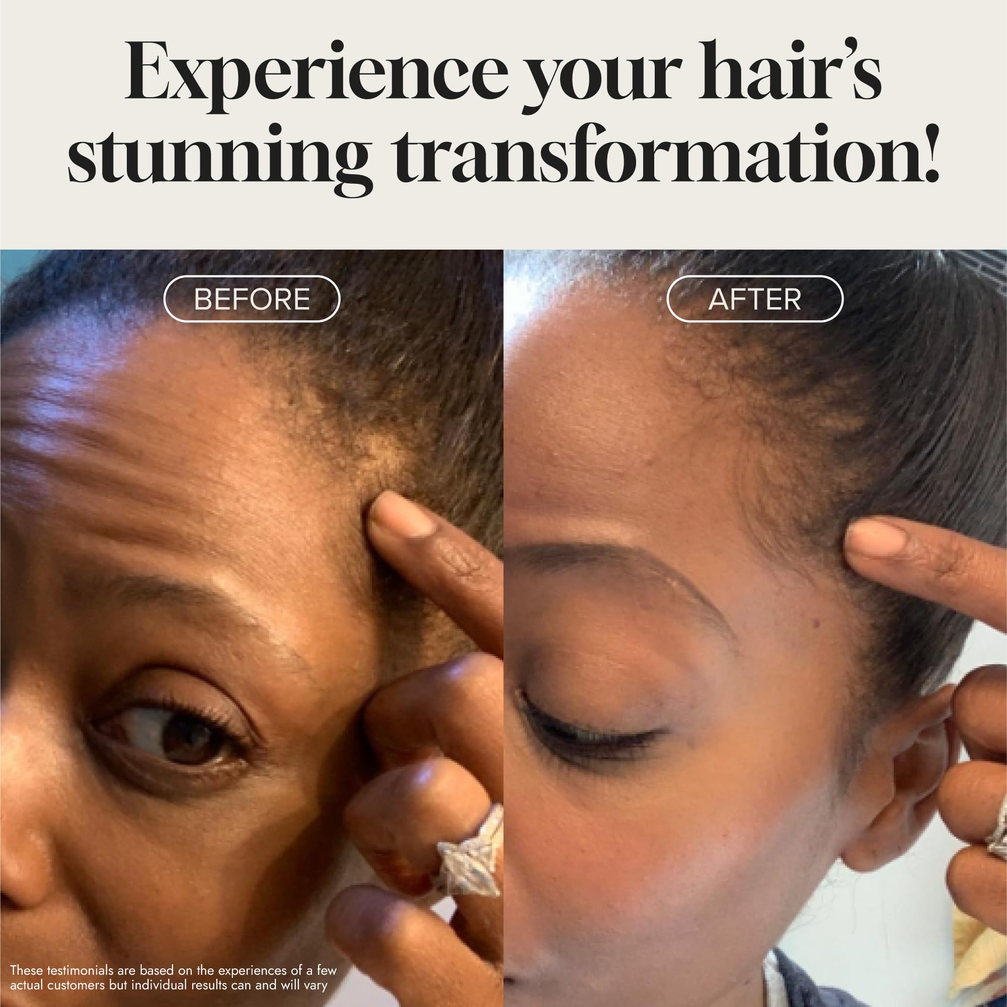Meraz Pureauty Naturals Biotin Hair Growth Serum on scalp for daily use.