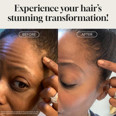 Meraz Pureauty Naturals Biotin Hair Growth Serum on scalp for daily use.
