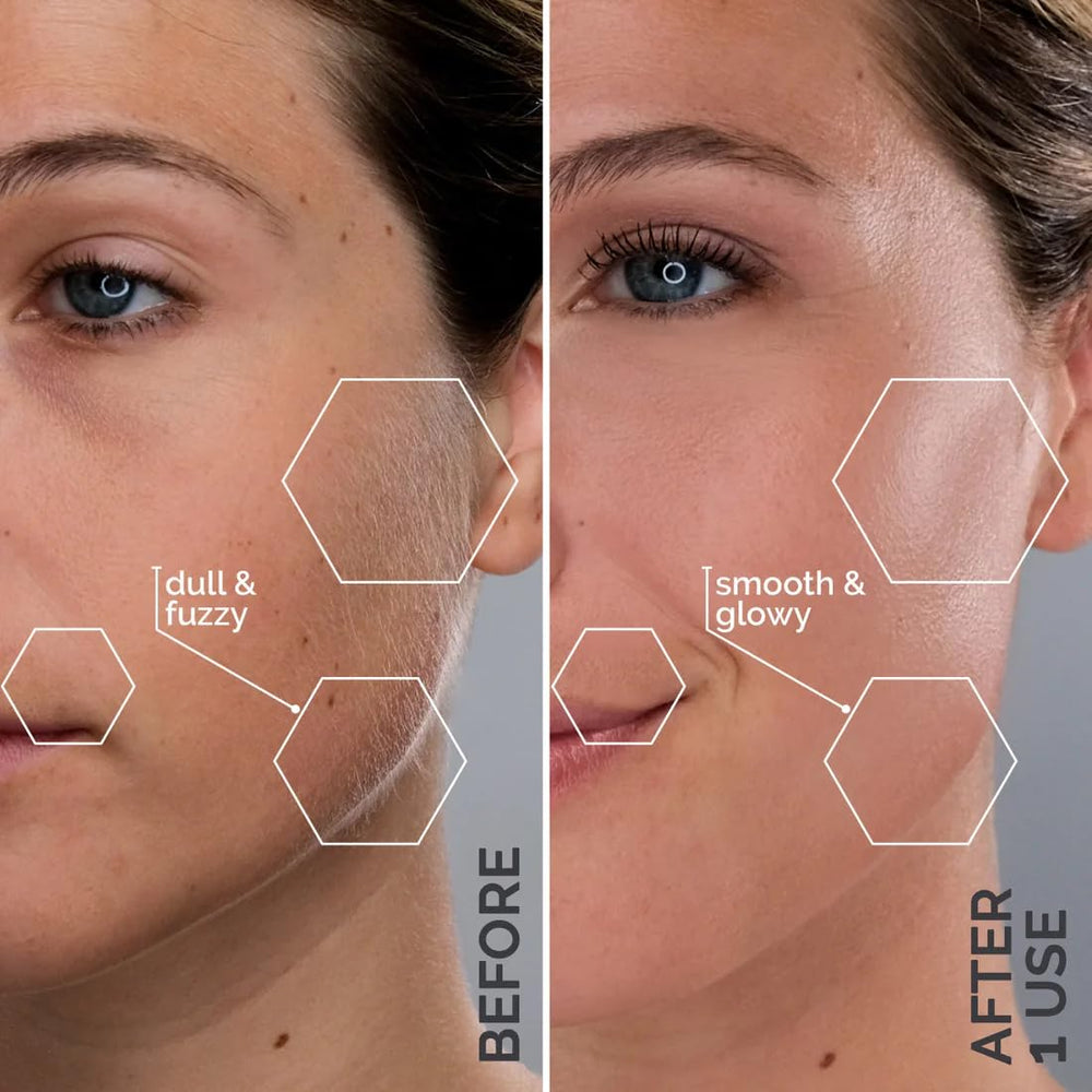 Michael Todd Sonicsmooth Pro+ blade refill close-up edge for clean exfoliation