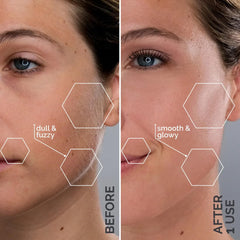 Michael Todd Sonicsmooth Pro+ blade refill close-up edge for clean exfoliation