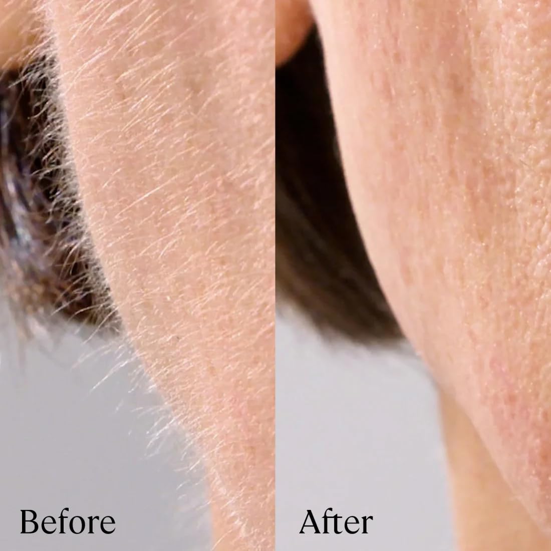 Michael Todd Sonicsmooth Pro+ skin-smoothing result on a clean cheek
