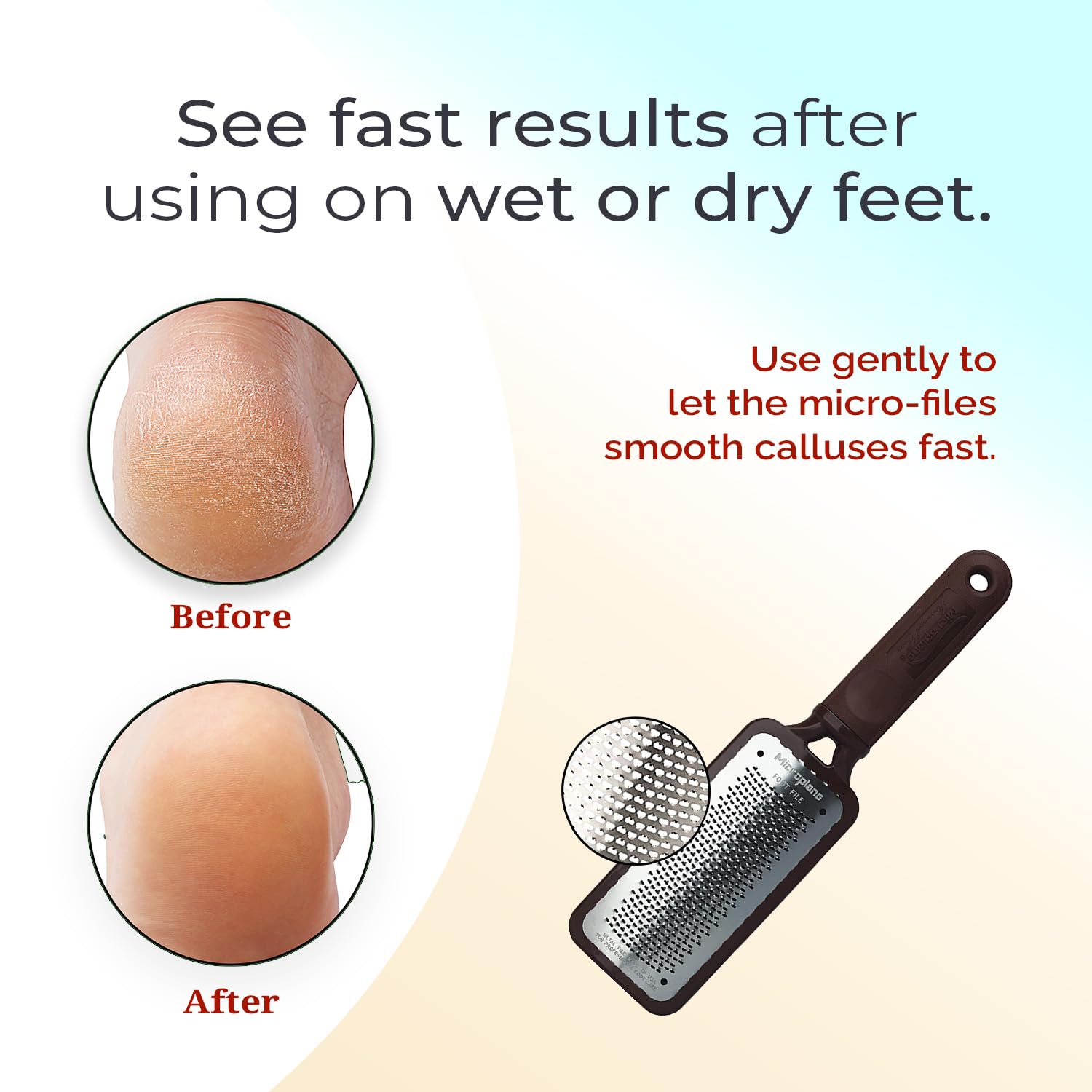 Microplane Colossal Foot File salon-grade tool for professional-quality foot care at home.