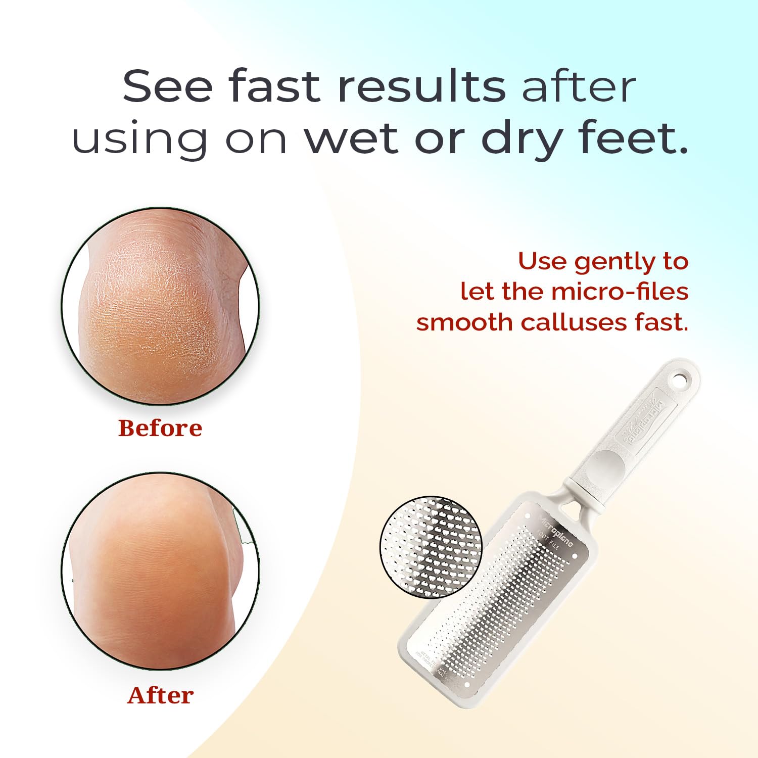 Microplane Colossal Foot File removable soft-grip handle for easy use.