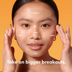 Mighty Patch Face XL nose zone patch targets blemishes overnight