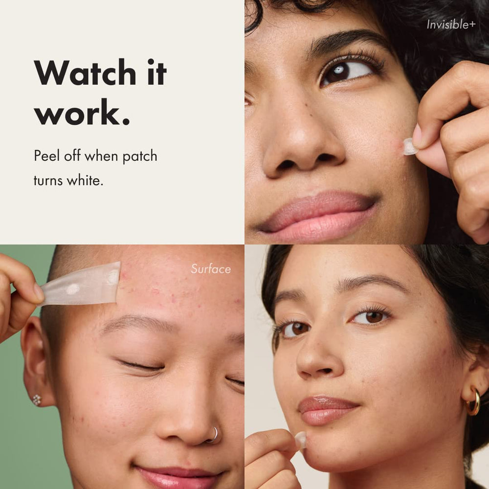 Mighty Patch Invisible+ on skin provides discreet coverage with translucent matte finish