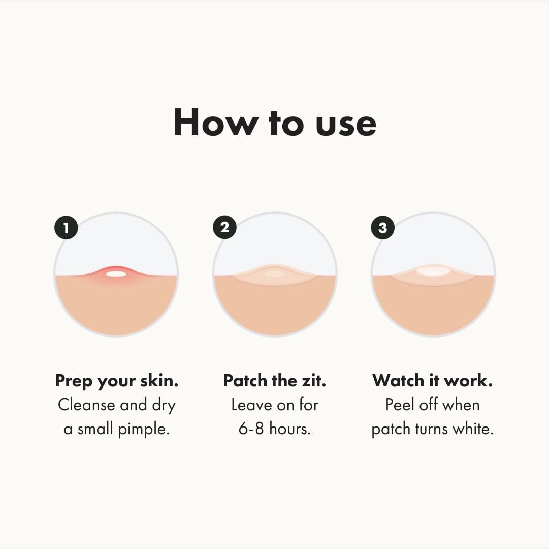 Mighty Patch Mini patch on blemish demonstrates reduced temptation to pick
