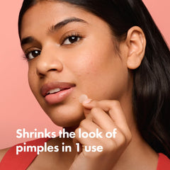 Mighty Patch Original on skin pimple demonstrates overnight look improvement.