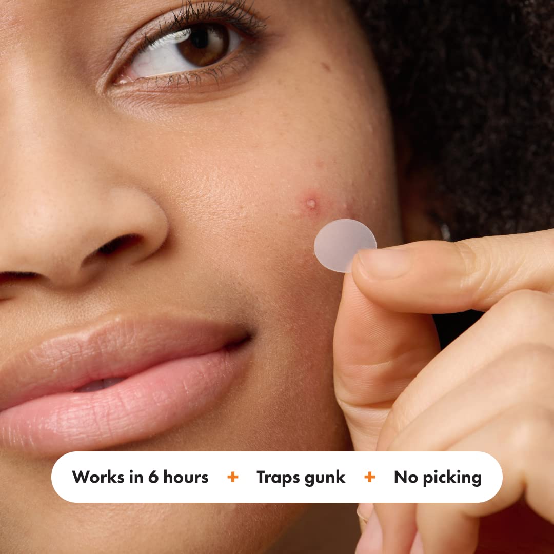 Mighty Patch Overnight adhesion on face stays through sleep for potential improvement