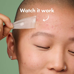 Mighty Patch Surface jawline patch fits contours for big breakouts.
