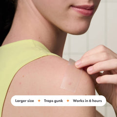 Mighty Patch Surface XL chest patch covers torso pimples discreetly.