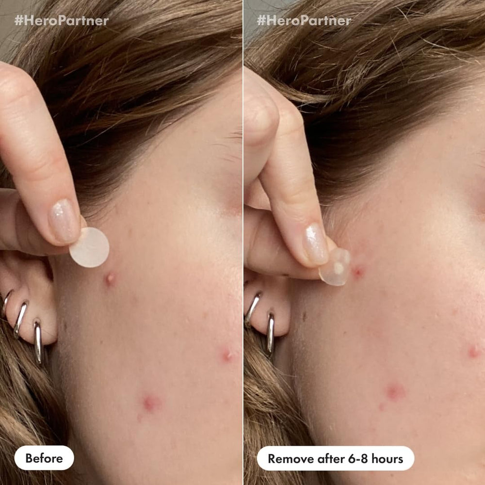 Mighty Patch Invisible+ alongside skin, edges blended for discreet wear