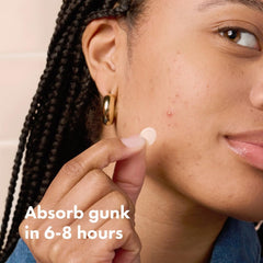 Mighty Patch gunk absorption close-up demonstrating hydrocolloid action