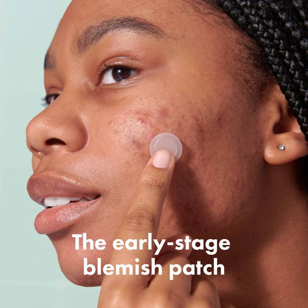 Mighty Patch Micropoint Large patch on blemish demonstrates discreet, breathable coverage