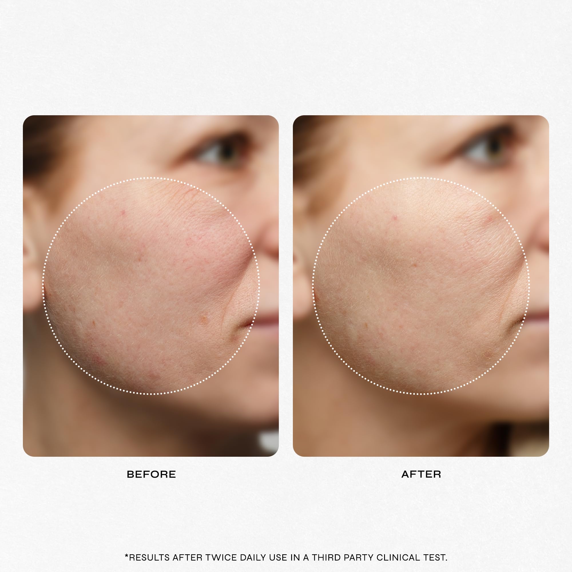 Milani Clean Start Prep Step redness-reduction closeup signals improved skin tone with regular use.