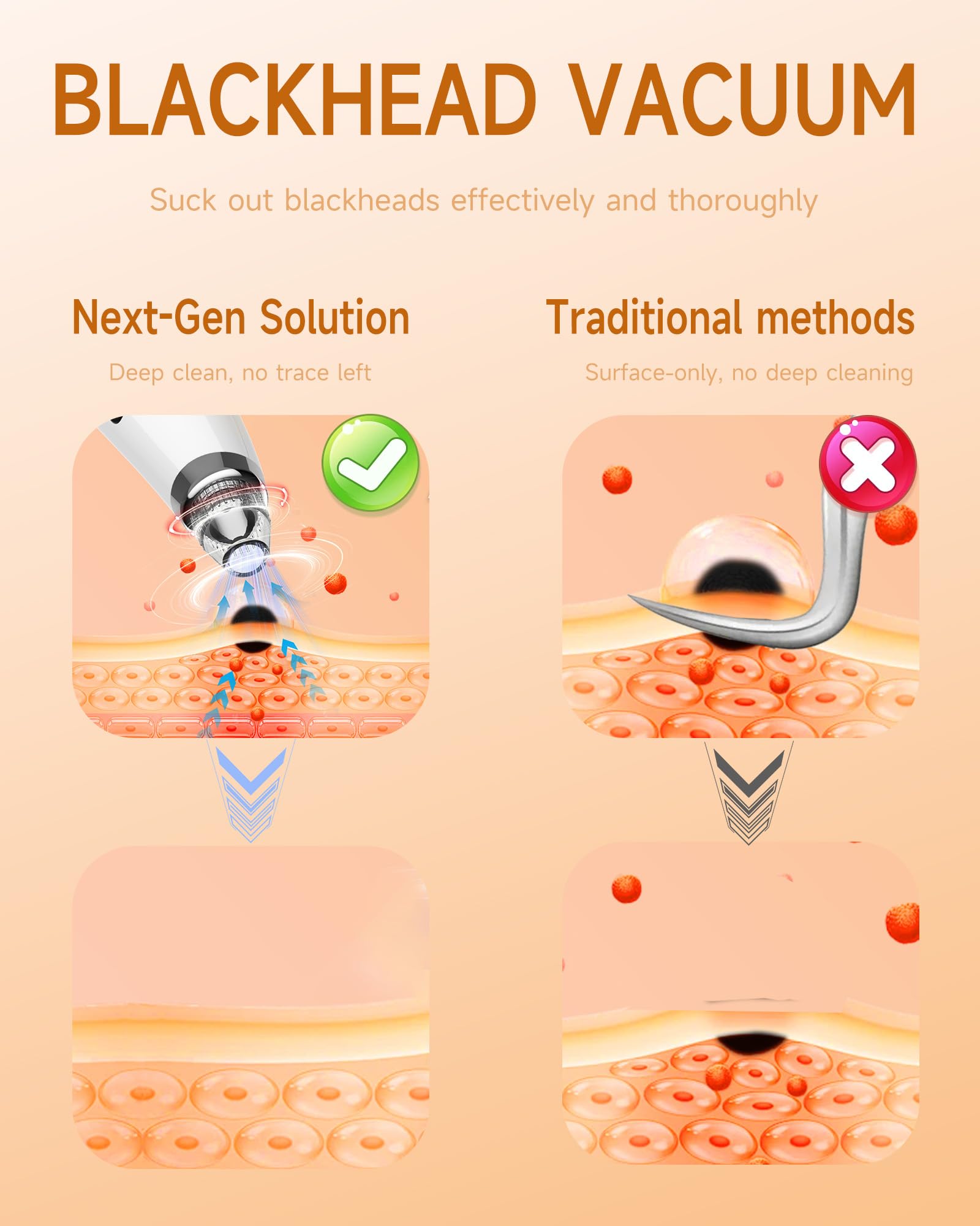 Miley blackhead remover vacuum performing deep-clean action on pores.