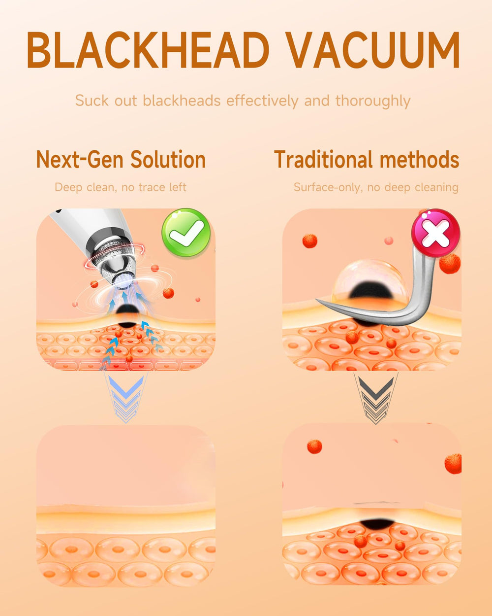 Miley blackhead remover vacuum performing deep-clean action on pores.