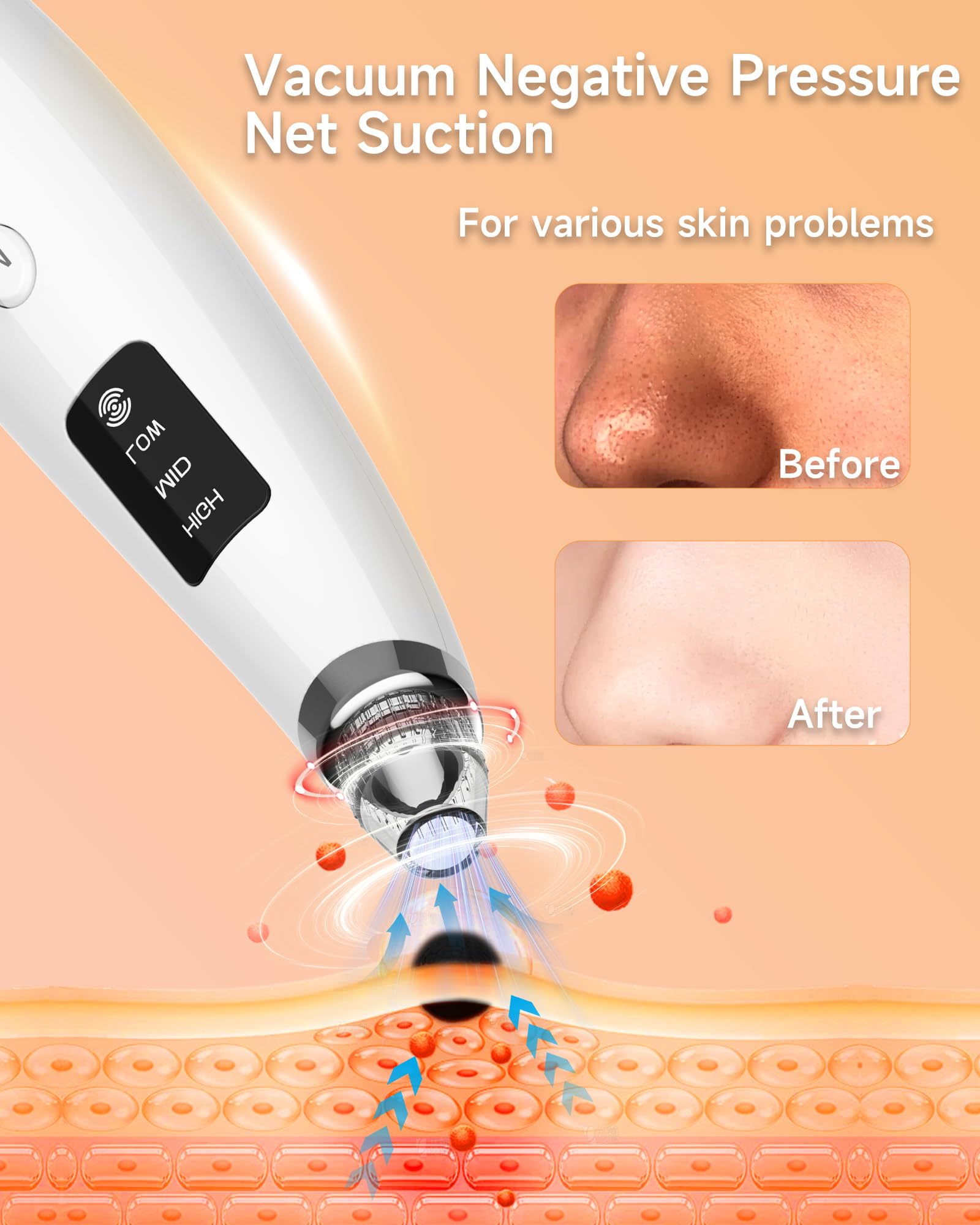 Miley blackhead remover vacuum with six-probe kit for targeted facial areas.