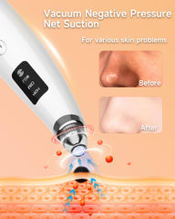 Miley blackhead remover vacuum with six-probe kit for targeted facial areas.