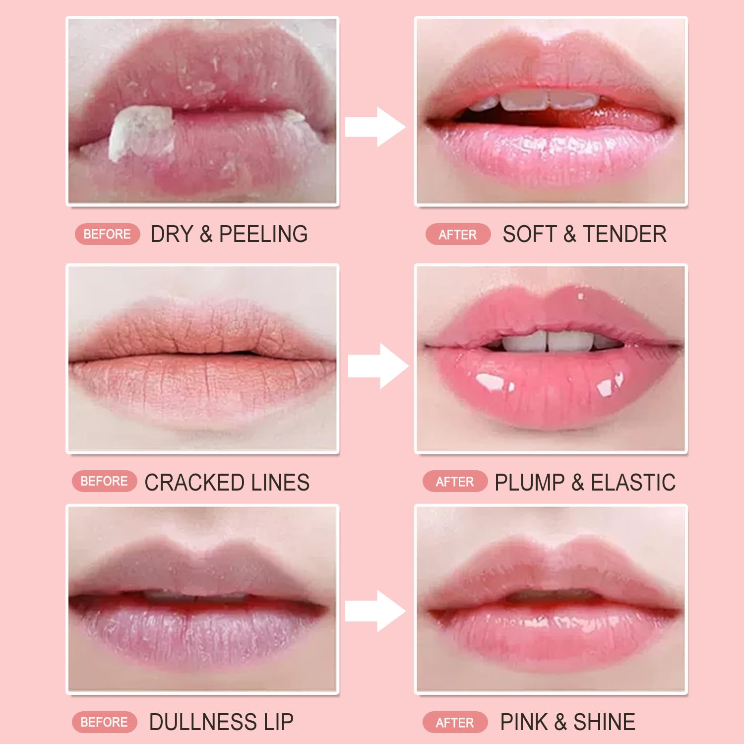 Miniling Dry lips before-and-after image illustrating hydrating effects
