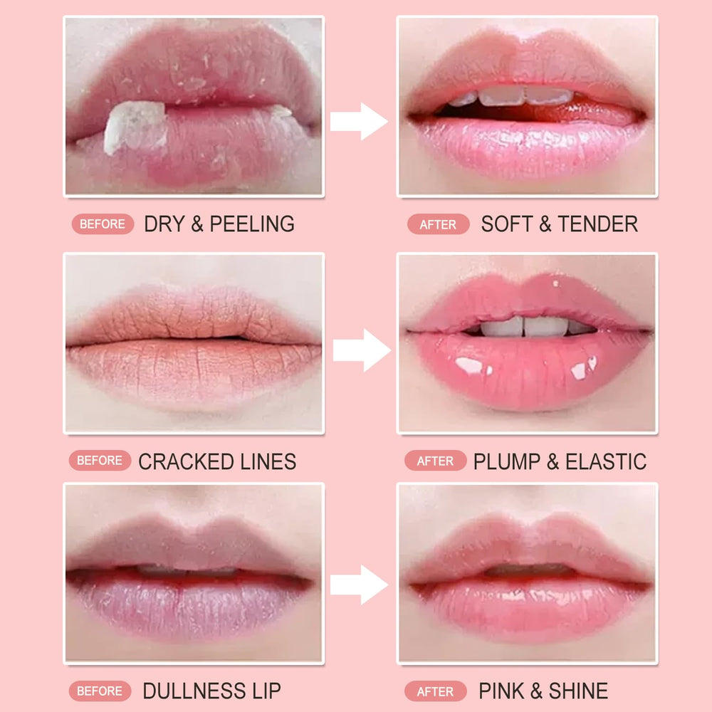 Miniling Dry lips before-and-after image illustrating hydrating effects