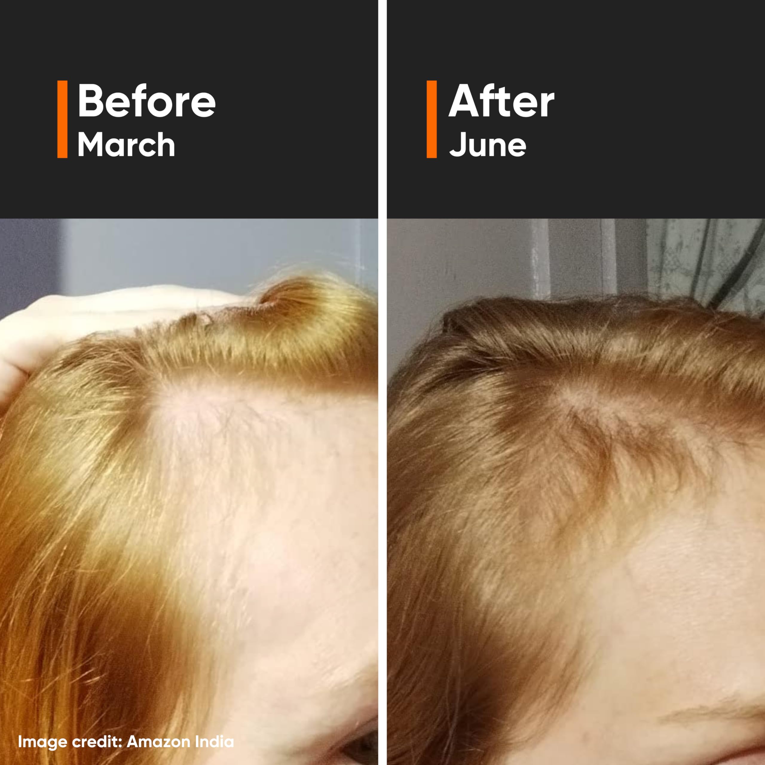 Minimalist Hair Density Serum dropper applying to scalp for even distribution.