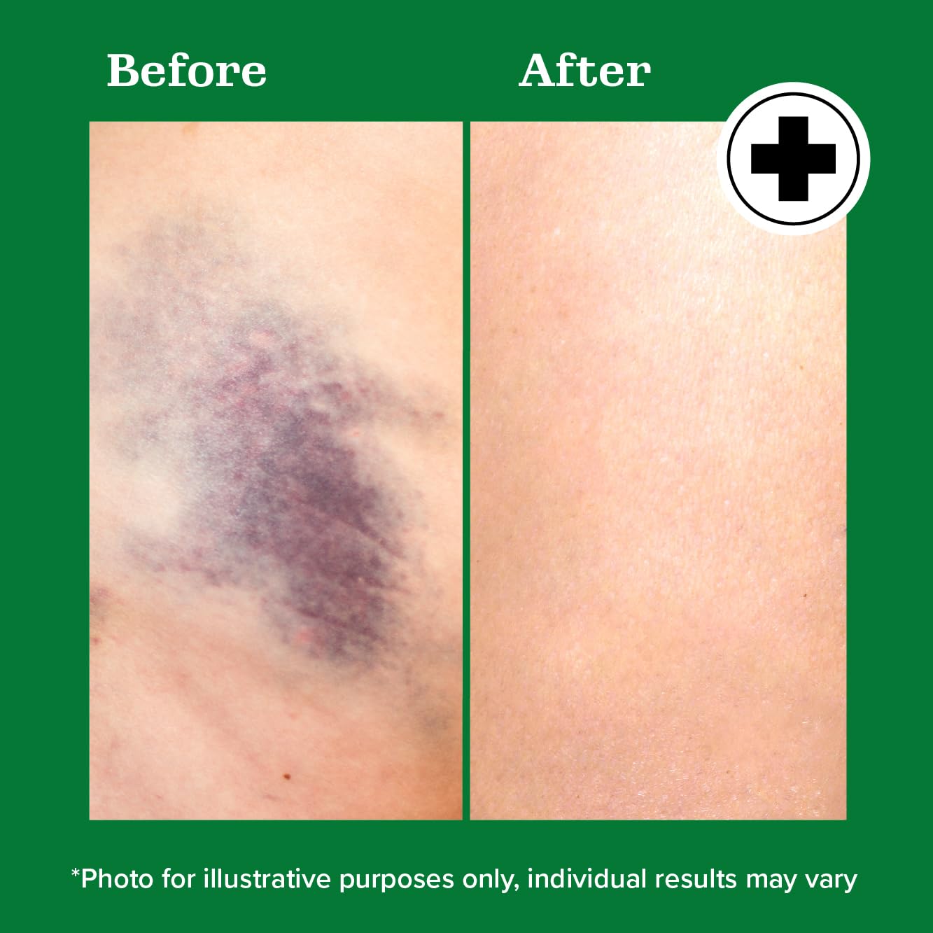 Miracle Plus Willowherb anti-redness highlight for calmer-looking skin.
