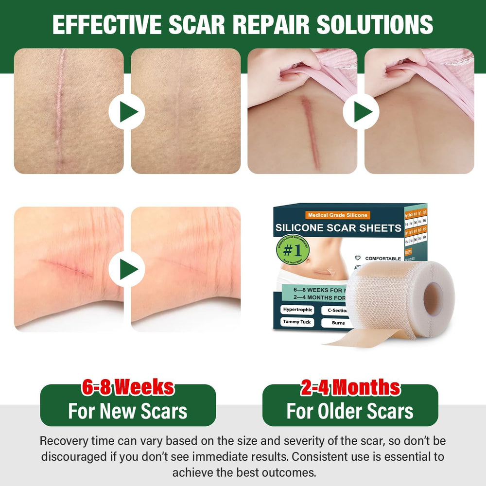 Mitreal scar tape appearance shows flexible, discreet coverage for surgical scars.