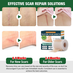 Mitreal scar tape appearance shows flexible, discreet coverage for surgical scars.