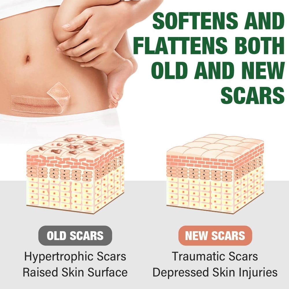 Mitreal silicone scar sheets reusable up to two weeks per sheet.