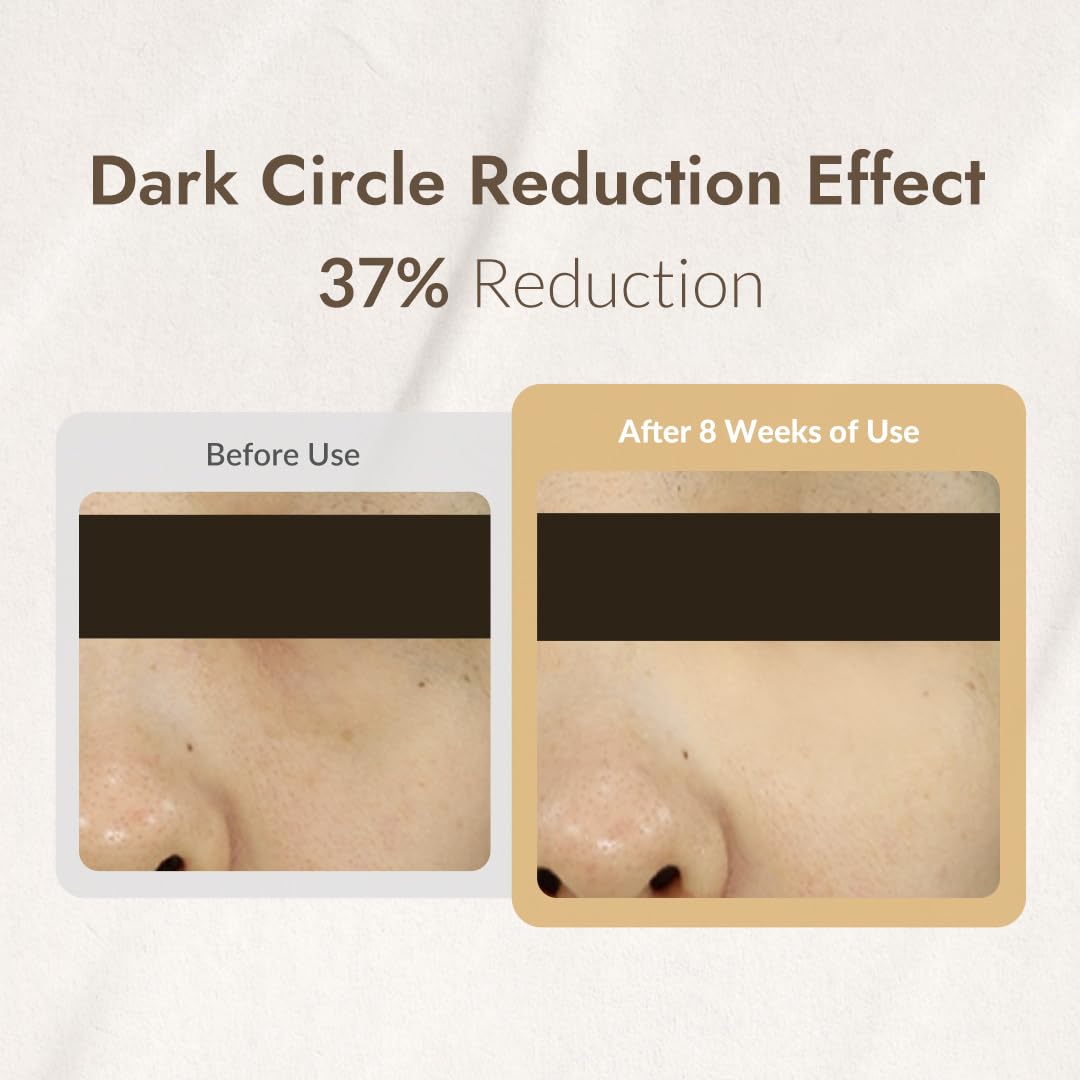 MIZON Snail Line Eye Cream texture swirls showing quick absorption and hydration.