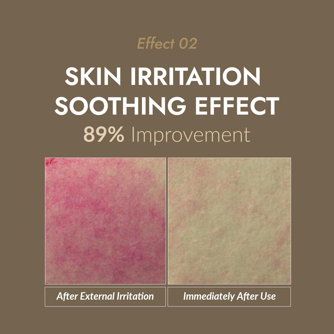 MIZON snail repair cream applied to skin demonstrates hydrating glow