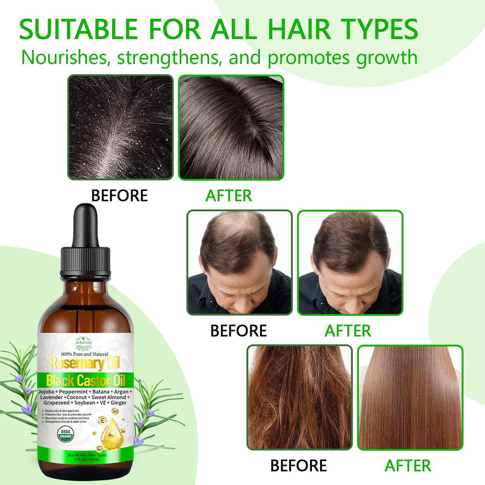 MMPANG rosemary oil pour action demonstrates easy application for scalp nourishment