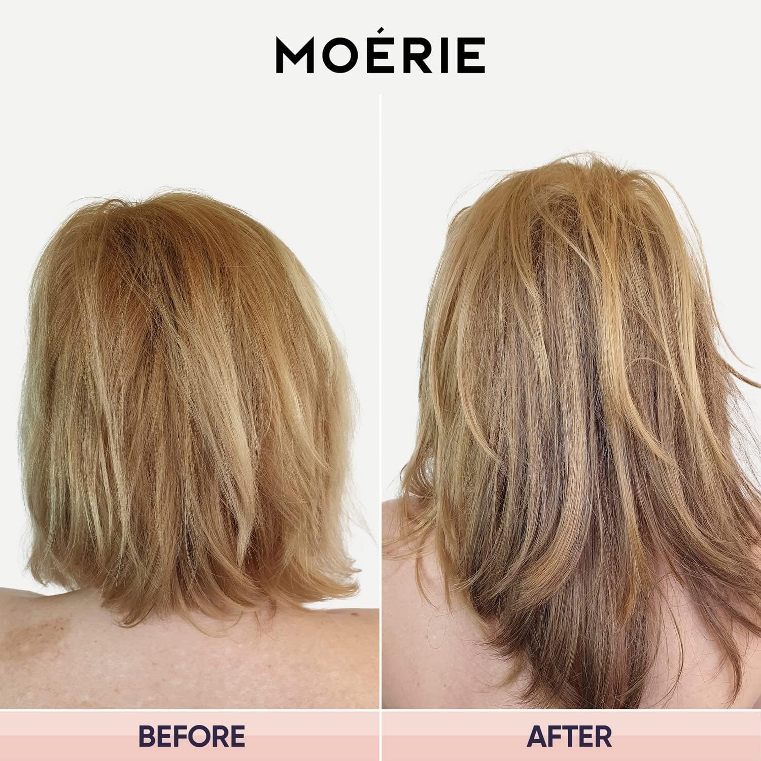 Moerie hair growth mask before-after visuals suggest fuller-looking hair over time.