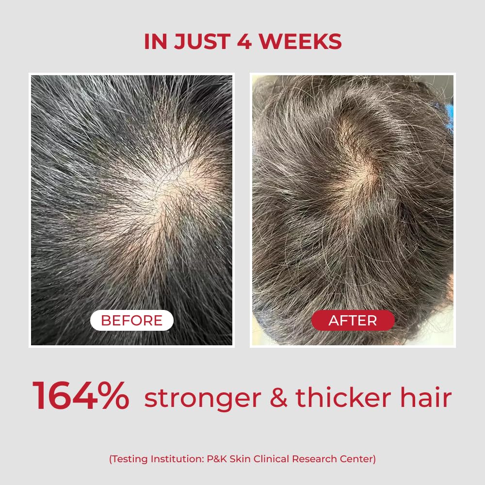 MOEV ANNURCATIN biotin icon suggests root strengthening and healthier hair appearance.