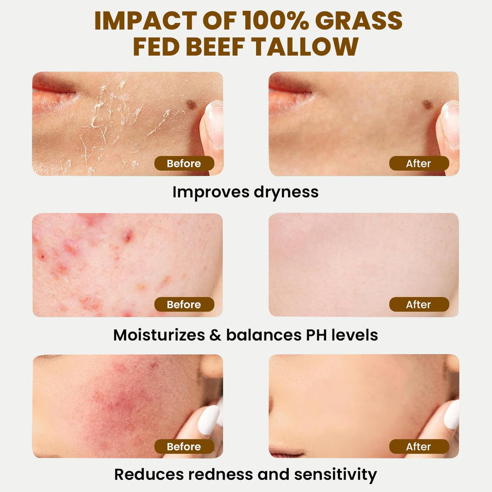 MONIER face-moisturizer-use close-up for gentle hydration on sensitive skin