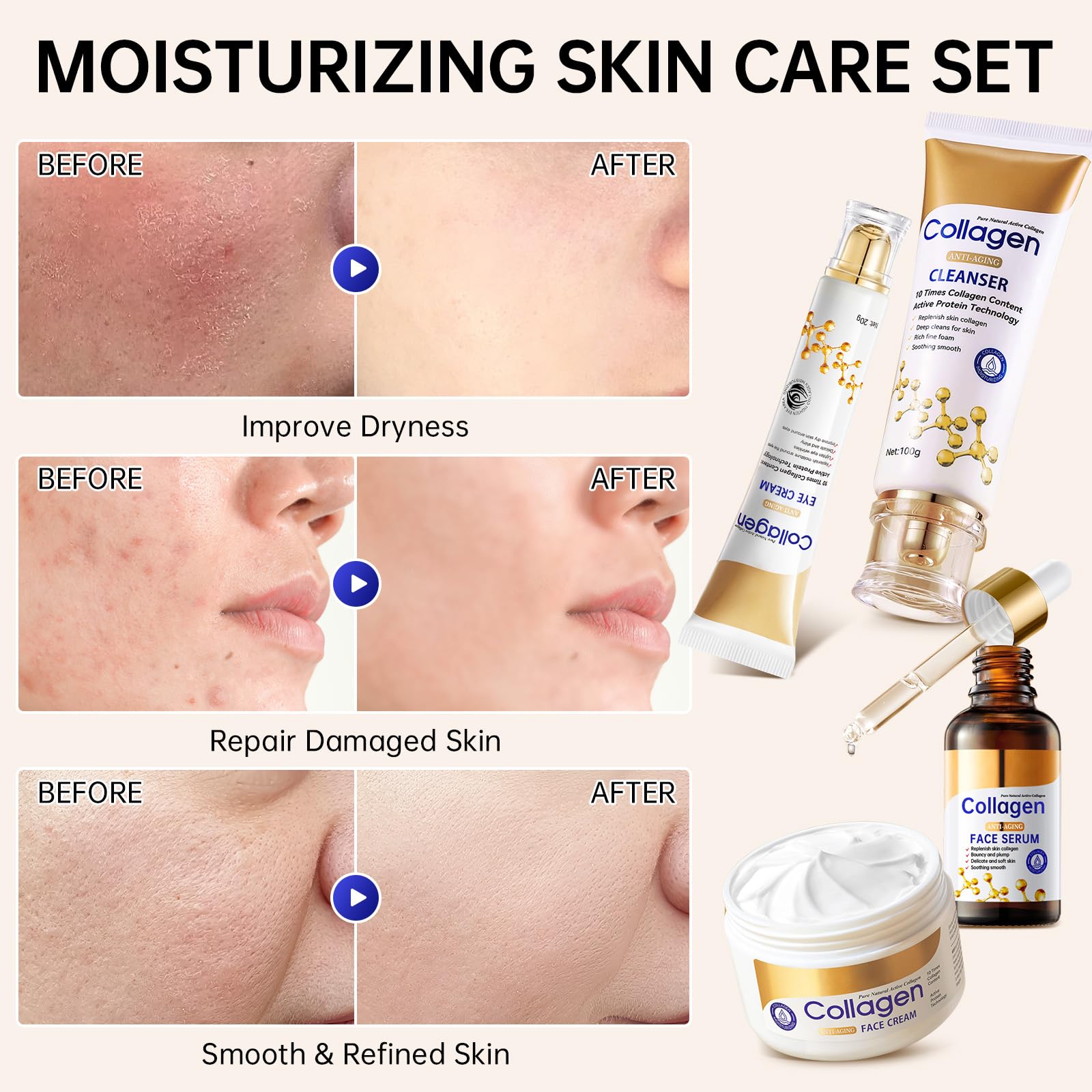 Mopayzer collagen-set-lip-balm smooths and hydrates lips