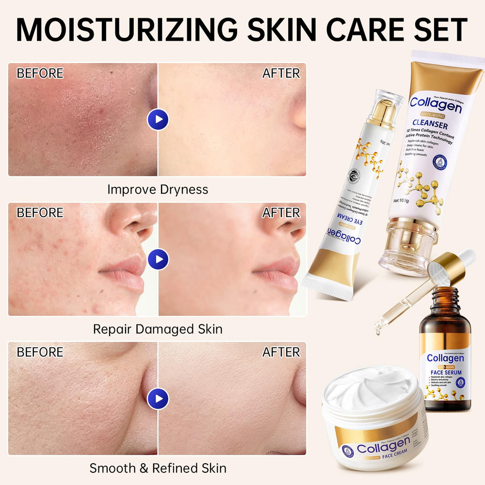 Mopayzer collagen-set-lip-balm smooths and hydrates lips