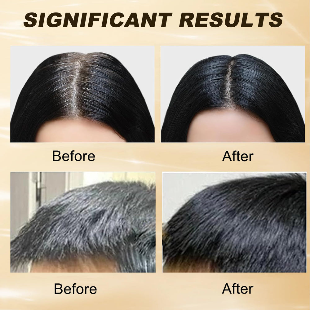 MoraZoge gray hair reverse bar soap for beard offers versatile coverage.