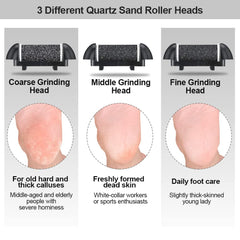 MOREVAC foot file LED spotlight helps target stubborn dead skin during use