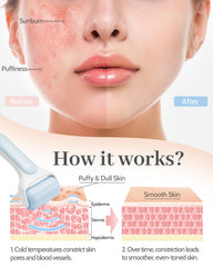 MORGLES Ice Roller contour-focused massage supports smoother facial contours.