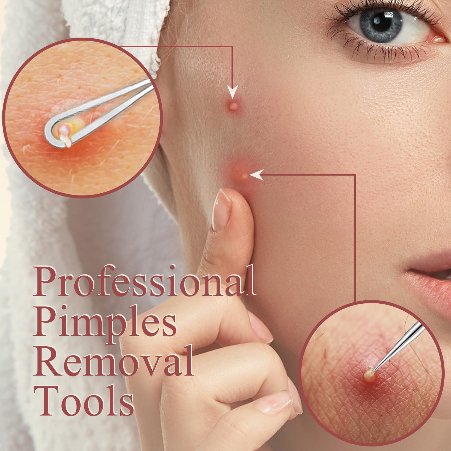 MORGLES Blackhead Extractor demonstrates curved and straight tips for blemish care