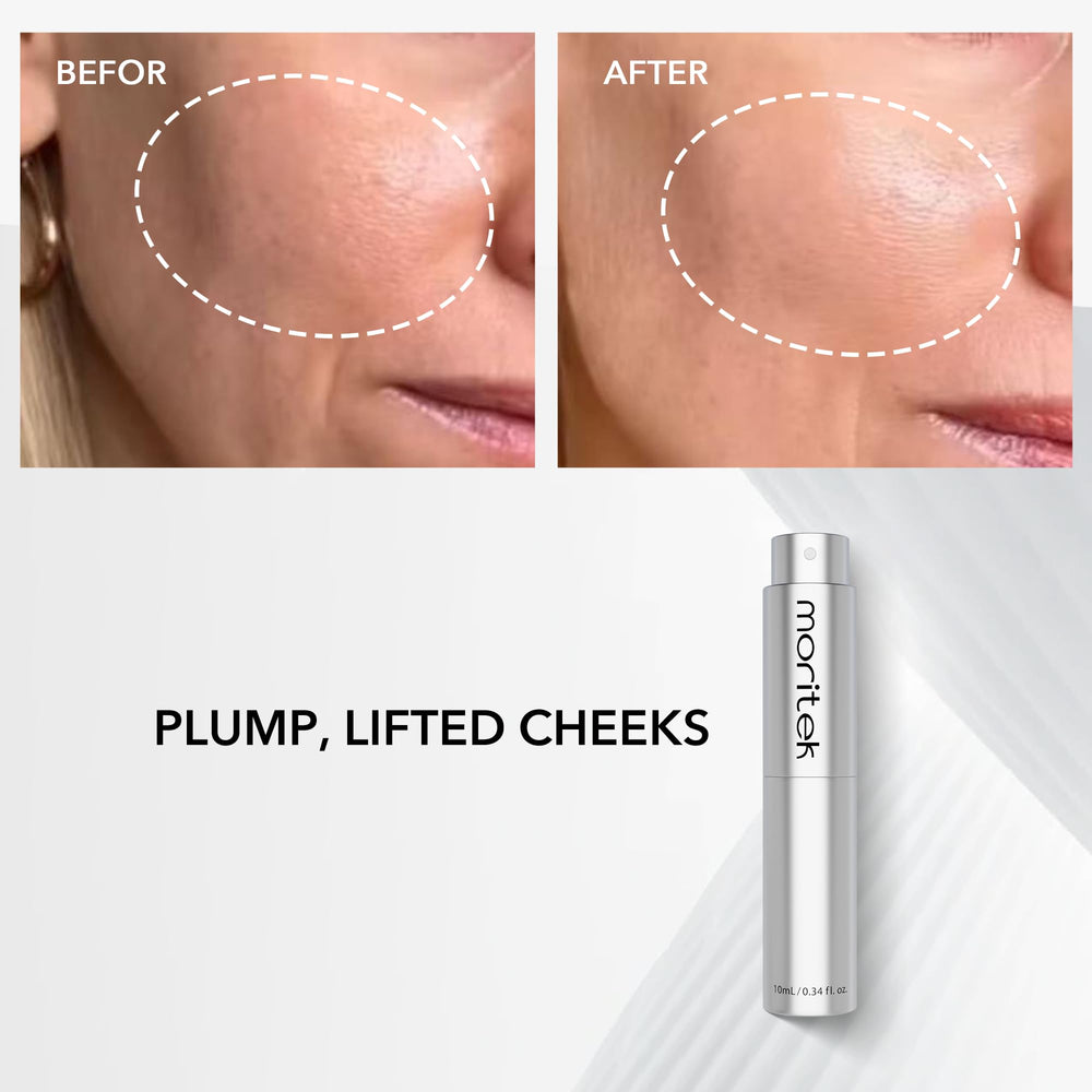 MORITEK Mori-Lift Mist before-after skin texture improvement visuals