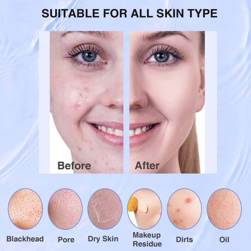 Mosnami face scrubber pores massage feature supports circulation-friendly cleansing.