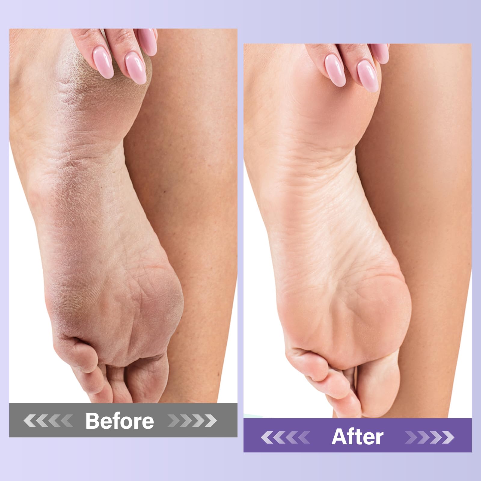 MOSRROU gift box foot care kit ready for birthdays or holidays.