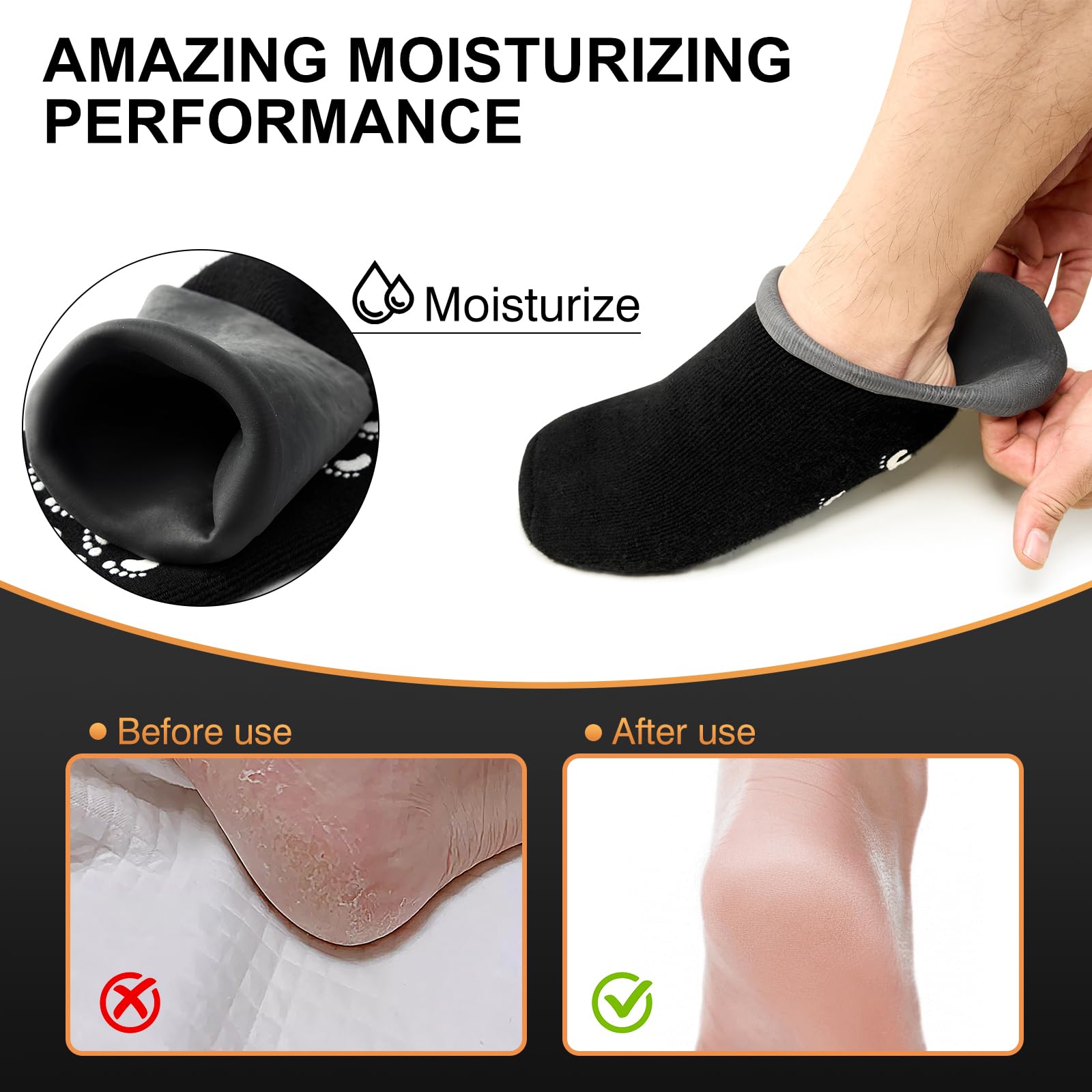MoyRetty exfoliating-socks-design shows dead-skin removal in action